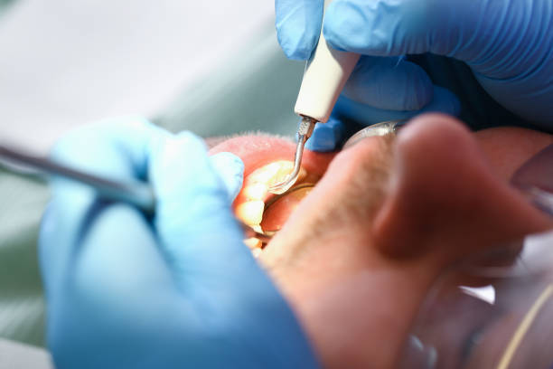 Best Broken Tooth Emergency  in Villa Ridge, MO